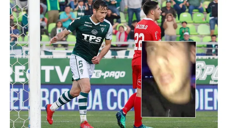 Jugador de Santiago Wanderers es visto en una discoteque y ataca a jóvenes que lo grababan (Foto: Agencia Uno)