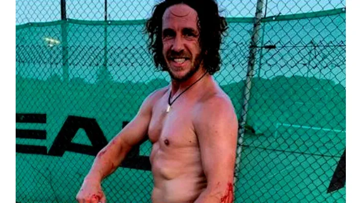 Tarzán herido: Carles Puyol termina ensangrentado a causa del Pádel