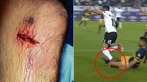 La lesión de San Juan pasó inadvertida por el mismo jugador