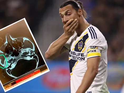 ¿Pelota o mala onda? Ibrahimovic fractura a rival en el clásico de Los Angeles