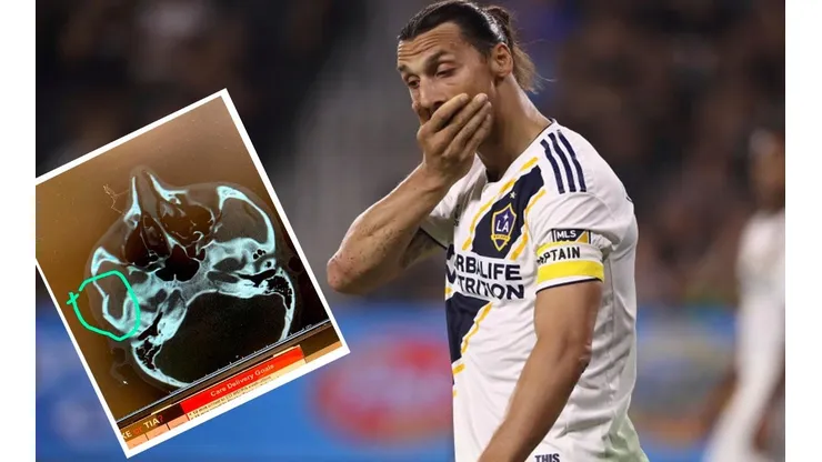 ¿Pelota o mala onda? Ibrahimovic fractura a rival en el clásico de Los Ángeles (Foto: Getty Images y Amro Tarek)