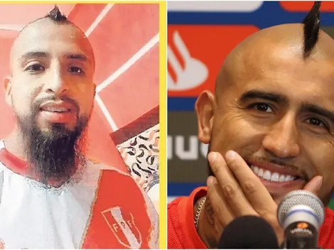 Grotesco imitador del King asegura que "el verdadero Vidal es peruano"