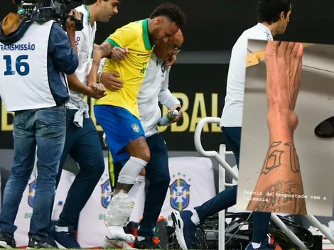 Neymar sale al paso y comparte foto de su tobillo