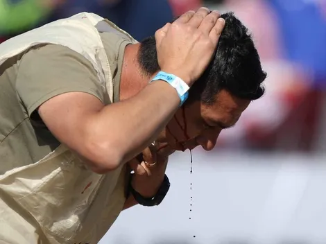 Colo Colo lleva a la justicia el proyectil que recibió su fotógrafo