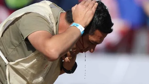 El resultado de la tontera de un estúpido. Pronta recuperación para el fotógrafo de Colo Colo.