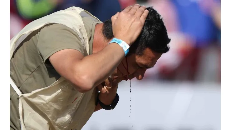 El resultado de la tontera de un estúpido. Pronta recuperación para el fotógrafo de Colo Colo.
