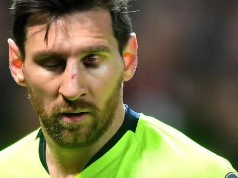 Messi no sufrió fractura de nariz en la Champions