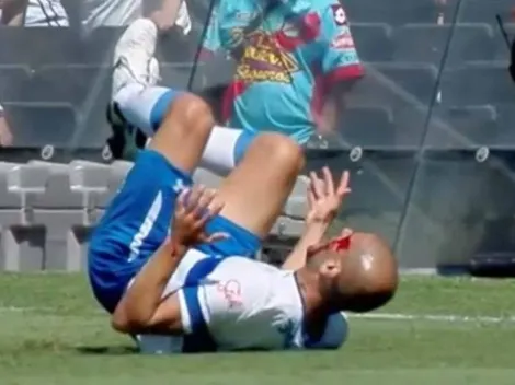 Al Sacha Sáez lo cortaron en la cara y le tiraron una falta horrorosa