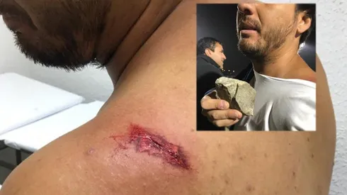 El hincha herido por el piedrazo.