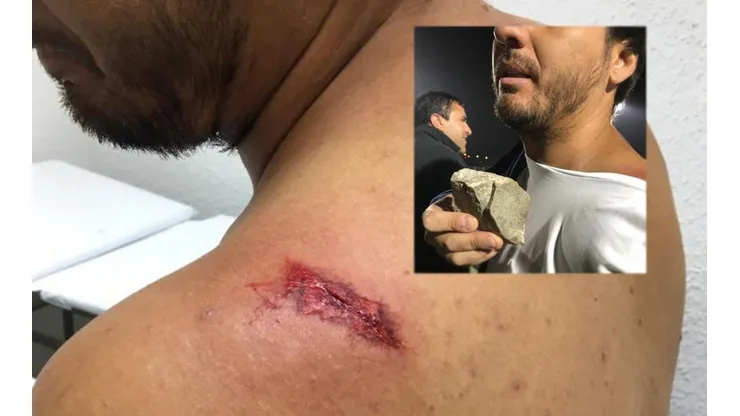 El hincha herido por el piedrazo.