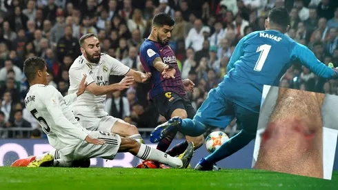 La acción que casi deja "sin rodilla" a Varane.