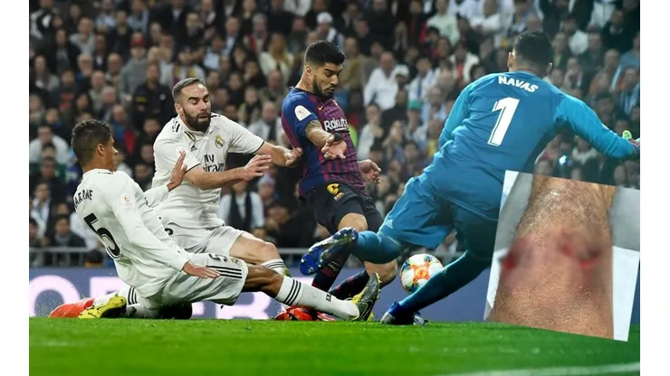 La acción que casi deja "sin rodilla" a Varane.