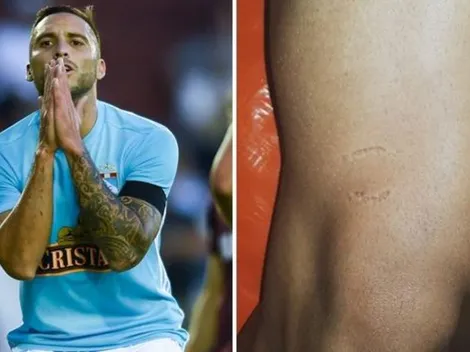 Peruano le muerde la pierna a Emanuel Herrera y le deja los dientes marcados