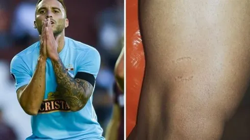 Jugador peruano mordió la pierna de Emanuel Herrera