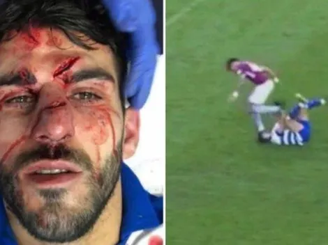 Jugador del Aston Villa se disculpa después de desfigurar a rival