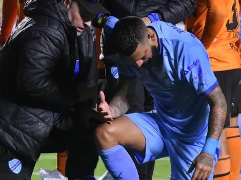 Ronnie se fracturó y deberá ser operado en el Bolívar