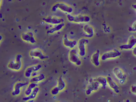 Conoce a la peligrosa Ameba comecerebros