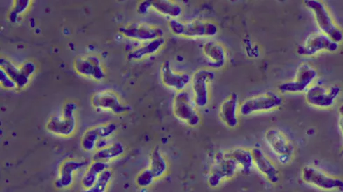 La Naegleria fowleri o ameba comecerebros bajo el microscopio.