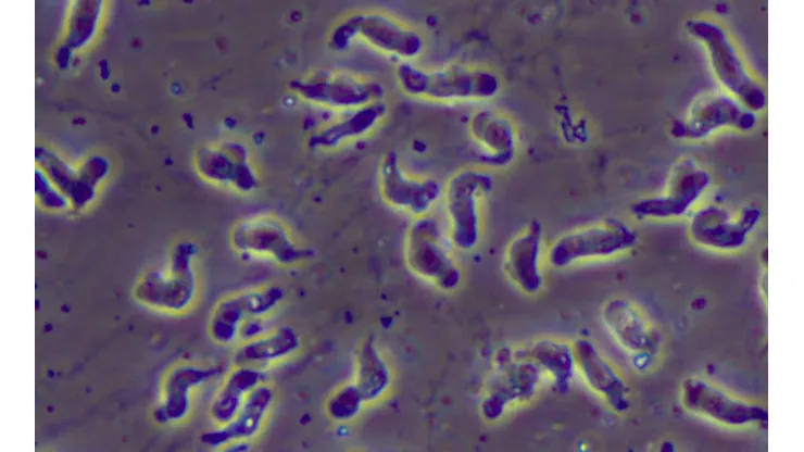 La Naegleria fowleri o ameba comecerebros bajo el microscopio.