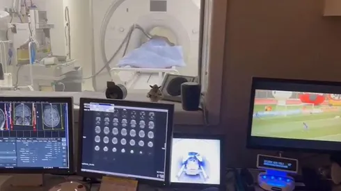 Experimento con resonancia magnética