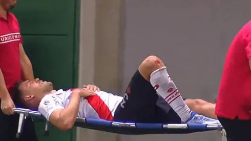 Matías Cahais sufrió una lesión terrible en La Florida