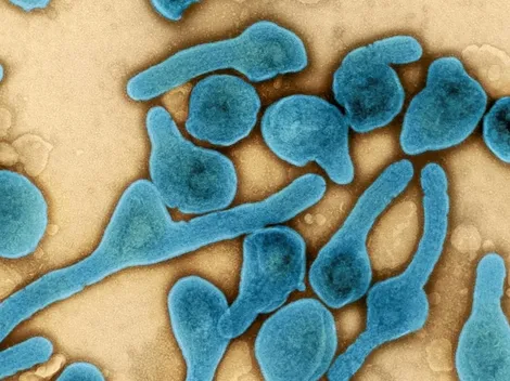 ¿Qué es el virus de Marburgo?