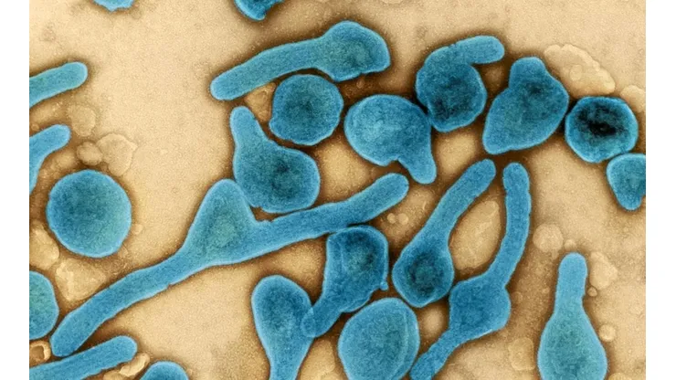 Virus de Marburgo