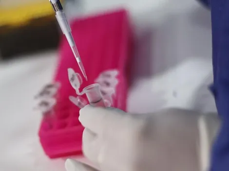 Viruela del mono | ¿Cómo se contagia y cuáles son los síntomas de esta enfermedad?