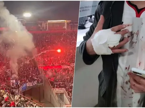 Otro bengalazo en la Copa deja herido a hincha de Estudiantes