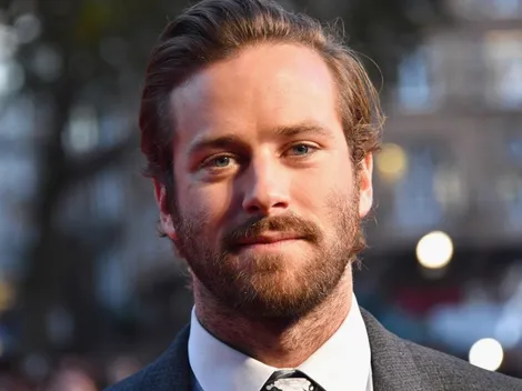 Armie Hammer pierde otro proyecto tras escandalosas