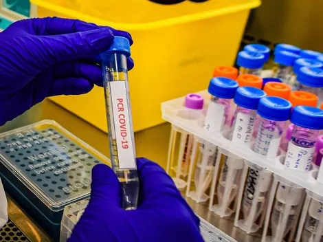 Temuco se convierte en la comuna con más casos activos de Covid-19