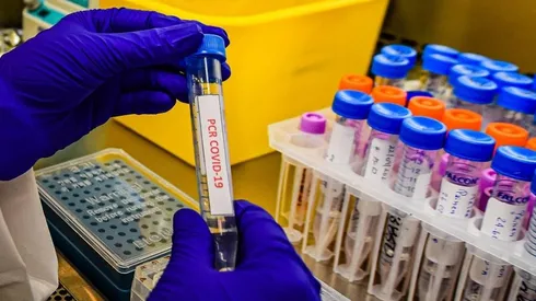 Temuco se convierte en la comuna con más casos activos de Covid-19 | Foto: Agencia Uno