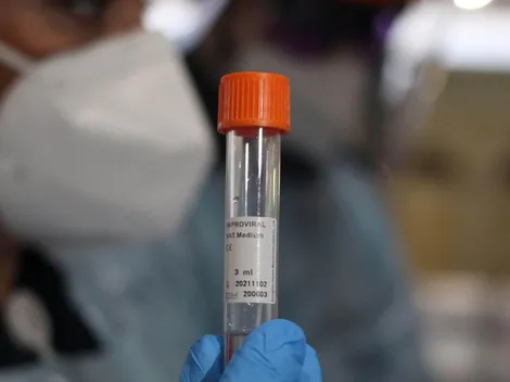 ¿Antes de ir a votar debo hacerme un examen PCR?