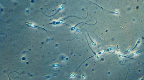 Covid-19 podría provocar infertilidad masculina | Foto: Getty Images