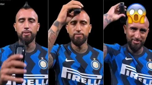 La escena de Arturo Vidal dejó con temblores a los fanáticos del King. ¿Debutará sin su mohicano en el Inter de Milán?