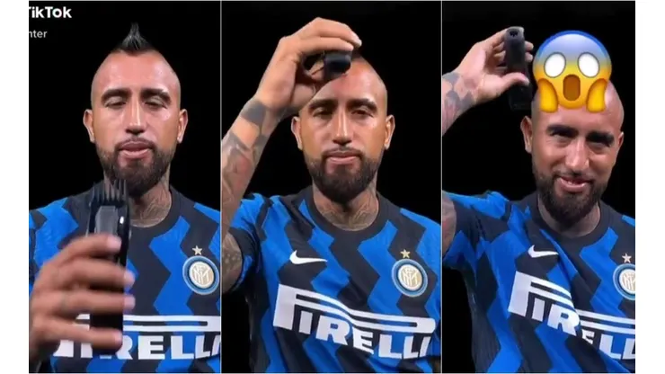 La escena de Arturo Vidal dejó con temblores a los fanáticos del King. ¿Debutará sin su mohicano en el Inter de Milán?
