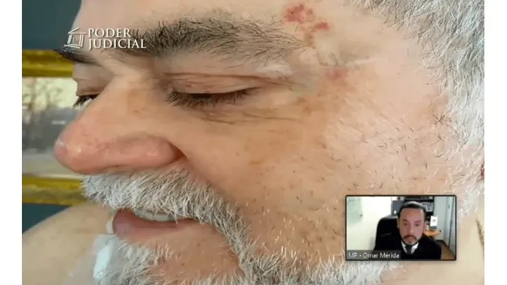 Parte de las heridas que le dejó Nano Calderón a su padre Hernán Calderón.