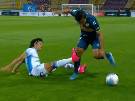 Eduard Bello y la maldición en Sausalito: se fracturó otra vez