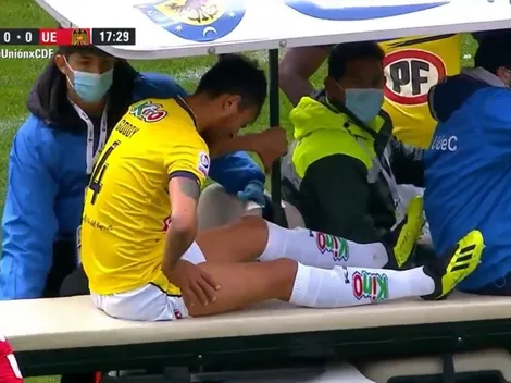 Accidentado primer tiempo entre UdeConce y UE