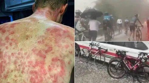 Los durísimos granizos golpearon las espaldas de los ciclistas.