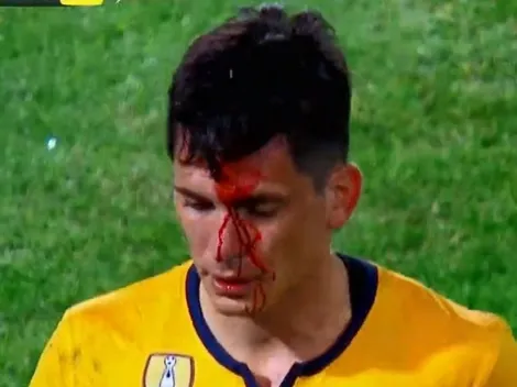 Parot recibe feroz codazo y pierde la final ante Boca