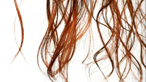 Caída de cabello por reconocida marca de shampoo.