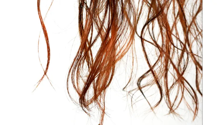 Caída de cabello por reconocida marca de shampoo.