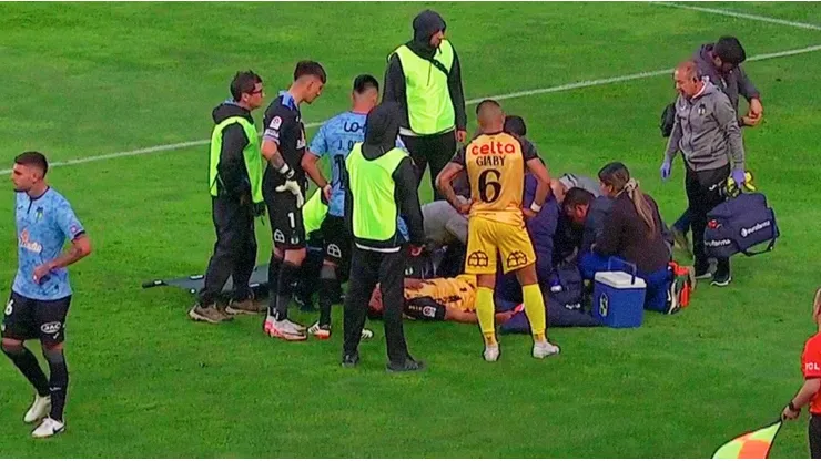 Enzo Mettifogo sufrió fractura de tibia y peroné en duelo de Coquimbo ante O'Higgins.