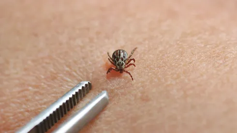 Descubren virus peligroso transmitido por garrapatas en China: ¿Qué tan peligroso es?