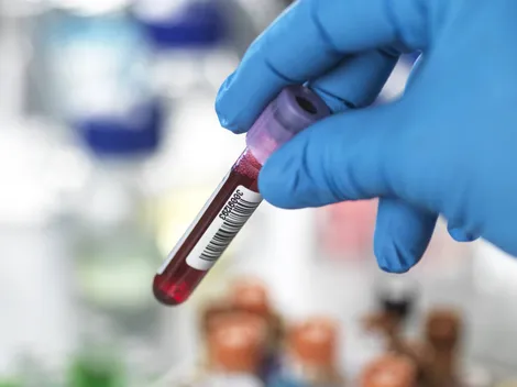 Descubre las formas de prevenir enfermedades cardíacas en mujeres