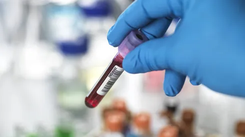 Descubre las formas de prevenir enfermedades cardíacas en mujeres