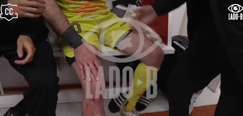 Captura YouTube | Lado B Colo Colo.