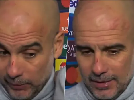 Video: Pep aparece todo rasguñado tras papelón del City