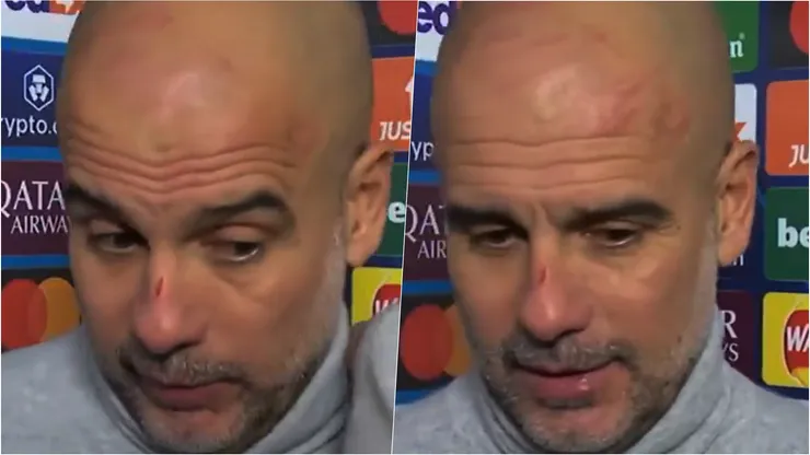 Pep Guardiola sorprendió al mundo con sus cortes en la cara tras empate del Manchester City.